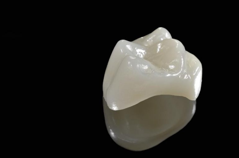 All Porcelain Crowns